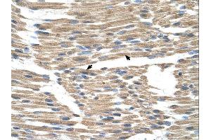 Immunohistochemistry (IHC) image for anti-Wntless Homolog (WLS) (N-Term) antibody (ABIN2781859)