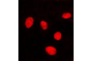 Immunofluorescent analysis of Lamin A/C staining in HeLa cells.