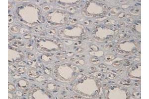 Immunohistochemical staining of formalin-fixed paraffin-embedded human kidney tissue with ADAMTS1 polyclonal antibody  at 1 : 100 dilution. (ADAMTS1 anticorps  (C-Term))