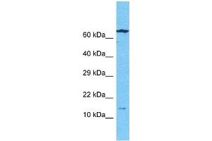 Host:  Rabbit  Target Name:  BMF  Sample Type:  Ovary Tumor lysates  Antibody Dilution:  1ug/ml (BMF anticorps  (N-Term))