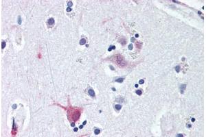 Anti-WNT8B antibody  ABIN1049486 IHC staining of human brain, cortex. (WNT8B anticorps  (C-Term))