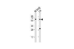 All lanes : Anti-Yes1 Antibody (Center) at 1:2000 dilution Lane 1: mouse lung lysates Lane 2: L6 whole cell lysates Lysates/proteins at 20 μg per lane. (YES1 anticorps  (AA 148-182))