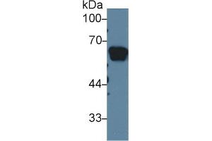 Detection of AGT in Rat Serum using Polyclonal Antibody to Angiotensinogen (AGT)