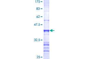 Image no. 1 for Mucin 4, Cell Surface Associated (MUC4) (AA 79-188) protein (GST tag) (ABIN1311640)