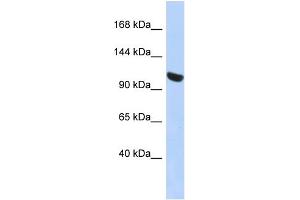 WB Suggested Anti-UBA1 Antibody Titration: 0. (UBA1 anticorps  (N-Term))