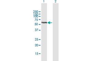 Western Blot analysis of TMPO expression in transfected 293T cell line by TMPO MaxPab polyclonal antibody.