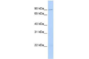 WB Suggested Anti-TMCC2 Antibody Titration:  0. (TMCC2 anticorps  (N-Term))