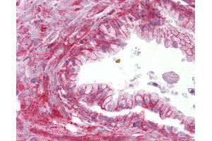 Anti-TMTC4 antibody IHC of human prostate. (TMTC4 anticorps  (AA 72-121))