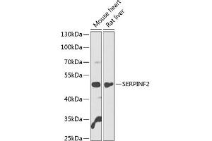 Western blot analysis of extracts of various cell lines, using SERPINF2 antibody  at 1:1000 dilution. (alpha 2 Antiplasmin anticorps  (AA 302-491))