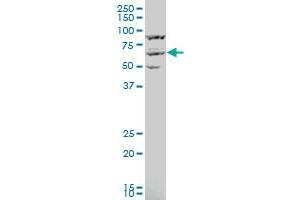 KPNA3 polyclonal antibody (A01), Lot # FAK0060120QCS1 Western Blot analysis of KPNA3 expression in IMR-32 . (KPNA3 anticorps  (AA 422-521))