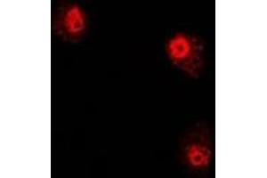 Immunofluorescent analysis of PHYH staining in U2OS cells. (PHYH anticorps)