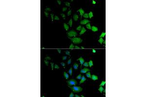 Immunofluorescence analysis of U2OS cell using PSG1 antibody. (PSG1 anticorps)