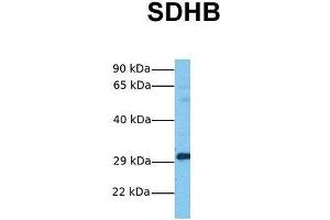 Host:  Rabbit  Target Name:  SDHB  Sample Tissue:  Human Fetal Lung  Antibody Dilution:  1. (SDHB anticorps  (Middle Region))