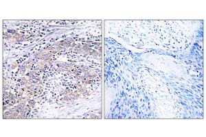 Immunohistochemistry analysis of paraffin-embedded human cervix tissue using CLN6 antibody. (CLN6 anticorps  (C-Term))