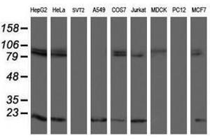 Image no. 12 for anti-TP53RK Binding Protein (TPRKB) antibody (ABIN1501484)