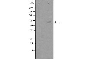 Western blot analysis of Hela whole cell lysates, using DDX5 Antibody.