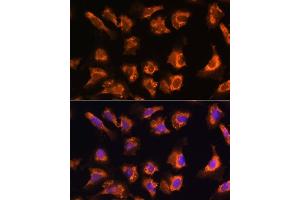 Immunofluorescence analysis of U-2 OS cells using OBSCN antibody (ABIN7269076) at dilution of 1:100. (Obscurin anticorps)