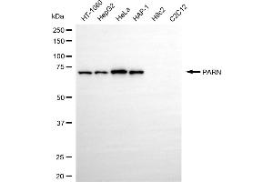 Western blotting analysis using PARN antibody (ABIN7799869).