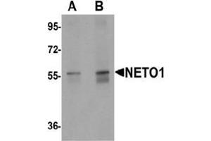 Western blot analysis of NETO1 in human lung tissue lysate with NETO1 Antibody  at (A) 1 and (B) 2 μg/mL. (NETO1 anticorps  (C-Term))