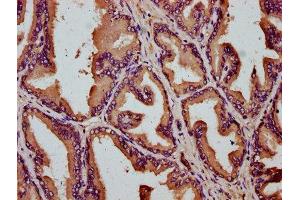 IHC image of ABIN7170215 diluted at 1:200 and staining in paraffin-embedded human prostate tissue performed on a Leica BondTM system.