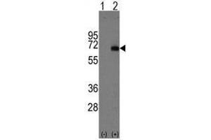 Image no. 1 for anti-alpha-Fetoprotein (AFP) (Center) antibody (ABIN356915) (alpha Fetoprotein anticorps  (Center))