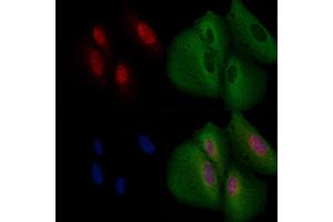 ABIN6264049 and ABIN6266617 staining  cells by IF/ICC.