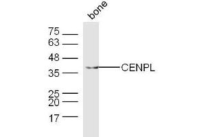 Mouse bone lysates probed with CENPL Polyclonal Antibody, Unconjugated  at 1:300 dilution and 4˚C overnight incubation. (CENPL anticorps  (AA 51-150))