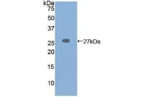Detection of Recombinant PRSS2, Mouse using Polyclonal Antibody to Protease, Serine 2 (PRSS2) (PRSS2 anticorps  (AA 29-240))