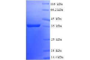SDS-PAGE (SDS) image for BCL2-Like 2 (BCL2L2) (AA 2-193) protein (His-SUMO Tag) (ABIN5711533)