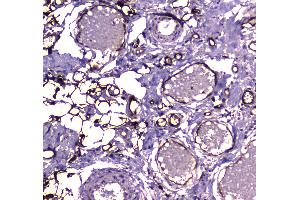 IHC analysis of FABP5 using anti-FABP5 antibody .