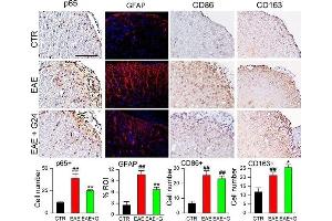 Chronic phase glibenclamide reduces inflammation and improves the macrophage phenotype in EAE. (CD86 anticorps  (AA 140-175))