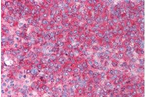 Human Spleen (formalin-fixed, paraffin-embedded) stained with CD82 antibody ABIN213919 at 0. (CD82 anticorps  (C-Term))