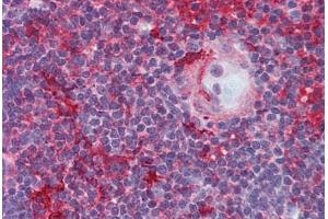 Human Thymus (formalin-fixed, paraffin-embedded) stained with LCK antibody ABIN296046 at 5 ug/ml followed by biotinylated anti-mouse IgG secondary antibody ABIN481714, alkaline phosphatase-streptavidin and chromogen. (LCK anticorps)