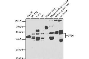 Western blot analysis of extracts of various cell lines, using IFRD1 antibody (ABIN6129279, ABIN6142215, ABIN6142217 and ABIN6223314) at 1:1000 dilution. (IFRD1 anticorps  (AA 1-240))