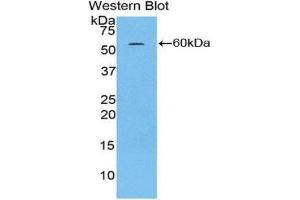 Western Blotting (WB) image for anti-H2A Histone Family, Member Y (H2AFY) (AA 109-369) antibody (ABIN1859115) (H2AFY anticorps  (AA 109-369))