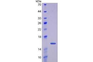 SDS-PAGE of Protein Standard from the Kit (Highly purified E. (GDF15 Kit CLIA)