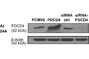 Western blotting analysis demonstrating over-expression or knock-down of PDCD4 using PDCD4 plasmid or PDCD4 targeted siRNA, respectively, versus control plasmids (PCMV6, siRNA ctrl) in the UT-SCC cell lines (A) 24A, (B) 74A, and (C) 87.