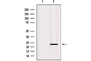 Western blot analysis of extracts from Mouse lung, using Caveolin-1 Antibody.