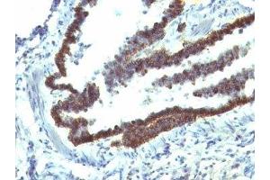 Formalin-fixed, paraffin-embedded rat lung stained with EpCAM antibody (EGP40/1110). (EpCAM anticorps  (Cytoplasmic Domain))
