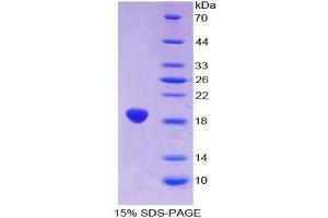 SDS-PAGE analysis of Human Aconitase 1 Protein.