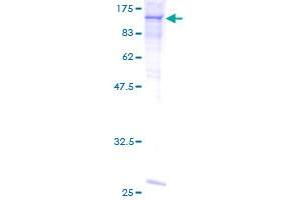 SDS-PAGE (SDS) image for Complement Component 6 (C6) (AA 23-934) protein (GST tag) (ABIN1776082)