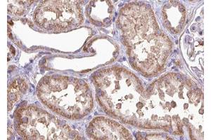 ABIN6267002 at 1/100 staining human kidney tissue sections by IHC-P.