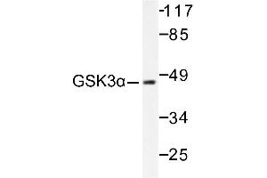 Image no. 1 for anti-Glycogen Synthase Kinase 3 alpha (GSK3a) antibody (ABIN265449) (GSK3 alpha anticorps)