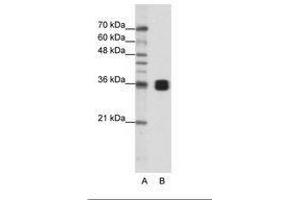 Image no. 1 for anti-Heterogeneous Nuclear Ribonucleoprotein A0 (HNRNPA0) (AA 154-203) antibody (ABIN202208) (HNRNPA0 anticorps  (AA 154-203))