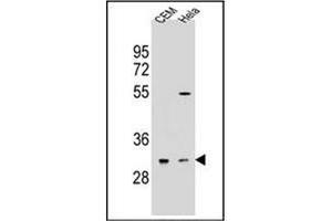 Western blot analysis of OR5L2 Antibody (N-term) in CEM,Hela cell line lysates (35ug/lane). (OR5L2 anticorps  (N-Term))