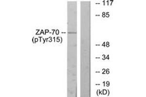 Western blot analysis of extracts from Jurkat cells treated with Ca+ 40nM 30', using ZAP-70 (Phospho-Tyr315) Antibody. (ZAP70 anticorps  (pTyr315))