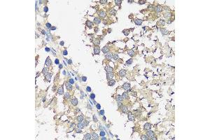 Immunohistochemistry of paraffin-embedded rat testis using  antibody  at dilution of 1:100 (40x lens).