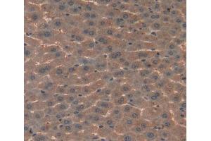Used in DAB staining on fromalin fixed paraffin- embedded Kidney tissue (Complement C4 anticorps  (AA 126-366))