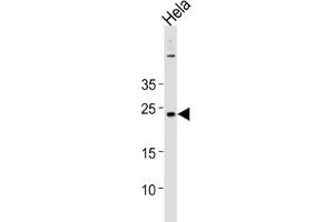 Western Blotting (WB) image for anti-Cappuccino Homolog (CNO) antibody (ABIN3004642) (BLOC1S4 anticorps)