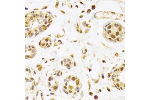 Immunohistochemistry of paraffin-embedded human breast using SEPHS1 Antibody (ABIN5973853) at dilution of 1/100 (40x lens). (SEPHS1 anticorps)